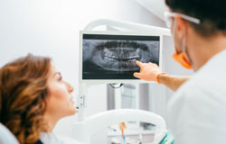 Digital radiography Digital radiography