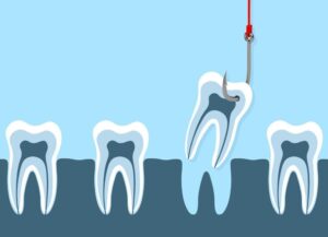 Mehr über den Artikel erfahren Dentalimplantate und ihre lebensverändernde Wirkung